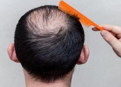 با این نوشیدنی تلخ ریزش مو را درمان کنید! با این نوشیدنی تلخ ریزش مو را درمان کنید!